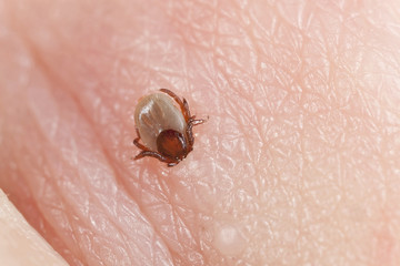 Tick, Ixodes ricinus biting human, extreme close-up