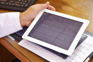 EKG auf Tablet Computer beim Arzt