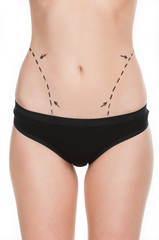 Fototapeta na wymiar Body improving. Cropped image of female body with marks on abdom