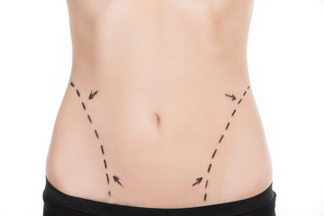 Fototapeta na wymiar Body improving. Close-up of female body with marks on abdomen