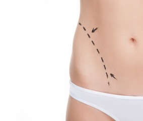 Body improving. Close-up cropped image of female body with marks