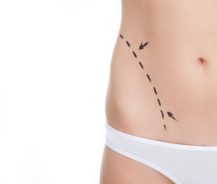 Body improving. Close-up cropped image of female body with marks