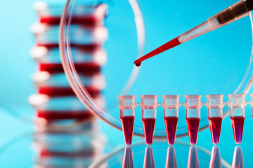Pipette and petri dish on a glass table in the lab