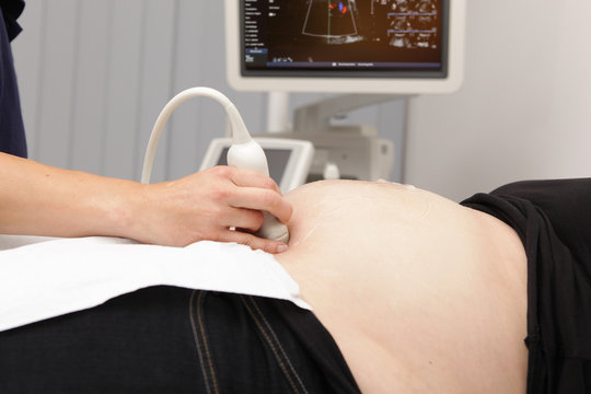 Ultraschalluntersuchung Schwangerschaft