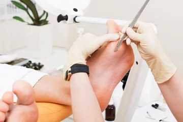 Fotobehang a pedicure foot © terex