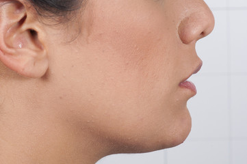 Sonrisa vista lateral