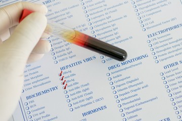 Blood sample for Hepatitis virus testing