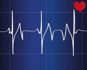 Heart beat