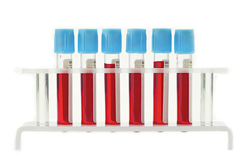 Tubes d'analyses biologiques
