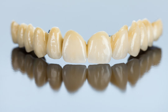 Procelain teeth on metallic basis