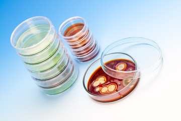 Mold growing in a Petri dish, on blue background