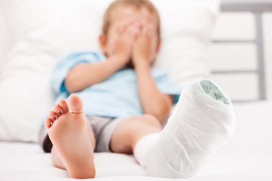 Little child boy with plaster bandage on leg heel fracture or br