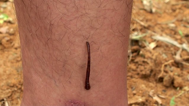 Jawed Land Leech attached to man's leg