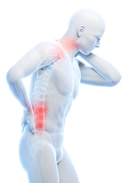 3d rendered illustration of a man having a painful back and neck