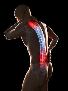 3d rendered illustration of a man having a painful back and neck