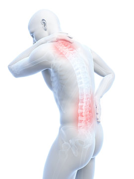 3d rendered illustration of a man having a painful back and neck