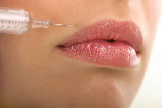 botox shot in the female cheek