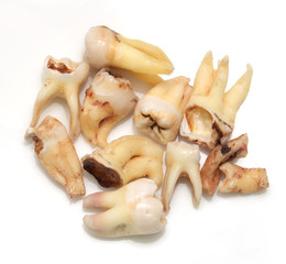 teeth with caries on a white background. macro