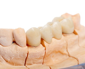 Teeth rehabilitation