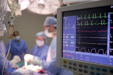 heart monitor in operating theater