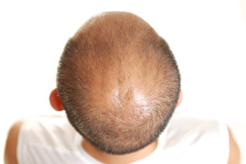 Fototapeta premium 薄毛