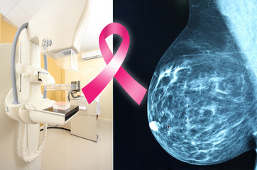 Pink ribbon for breast cancer awareness on mammogram image