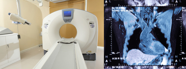 CT scan advance technology for medical diagnosis