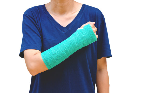 green cast on hand and arm isolated
