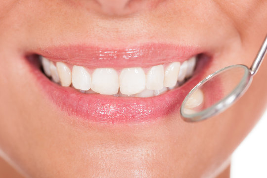 Smiling woman with perfect white teeth