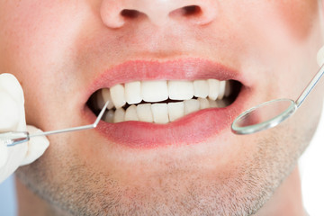 Dentist Examining Patient