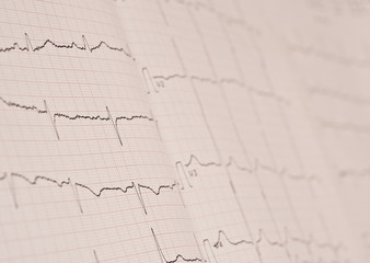 Detail of an electrocardiogram in paper