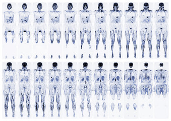 Complete real MRI scan of the human body, from the front and back