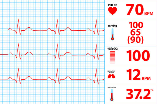 Modern Electrocardiogram Monitor Display