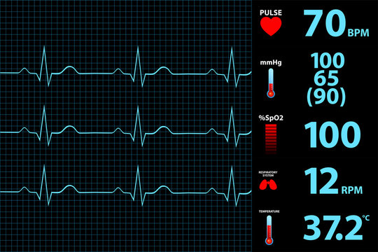 Medical Vital Signs Monitor Screen - Stock Motion Graphics