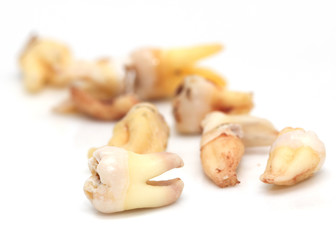 teeth on a white background. macro