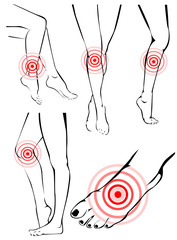 Legs pain