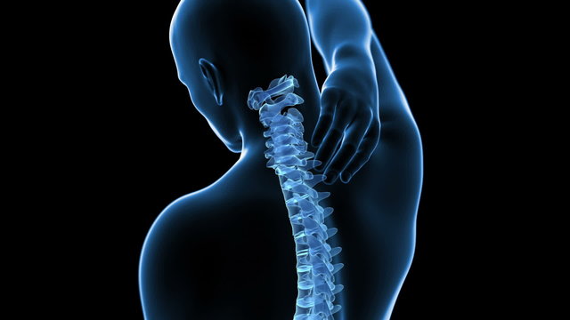 animation showing a painful neck