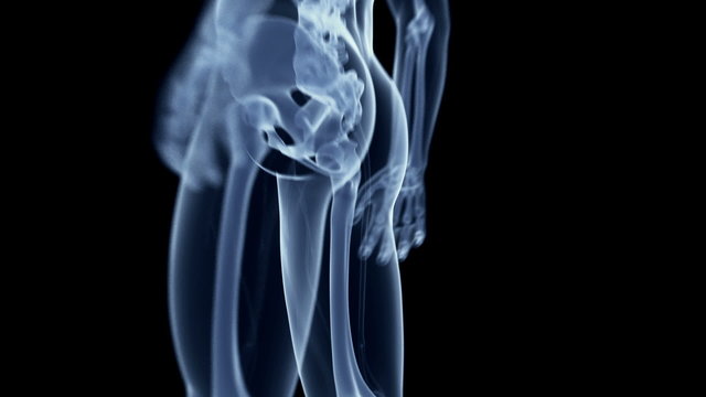 Animation showing a painful knee