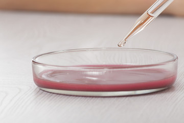 blood in petri dishes, test