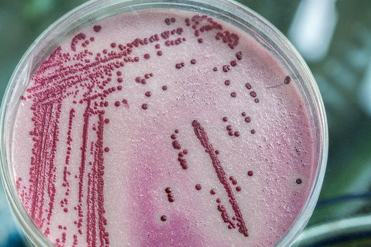 Pink and red microbacterias