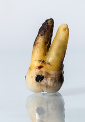 Plombierter Stockzahn