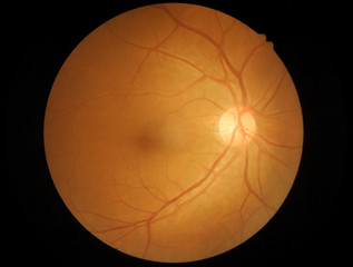 Medical photo retina and optic nerve - obrazy, fototapety, plakaty
