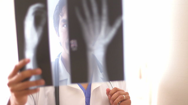 Hispanic doctor reviewing hand x-rays