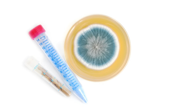 chemical compounds in tube and fungi on agar plate