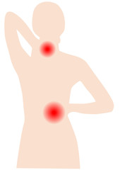 R&uuml;ckenschmerzen