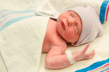Infant with eye gel applied moments after delivery at hospital