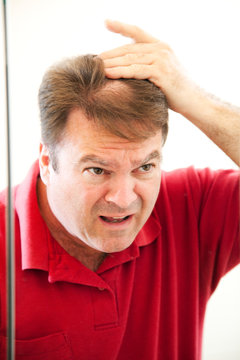 Mature Man With Bald Patch