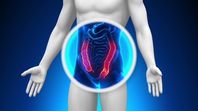 Medical X-Ray Scan - Colon