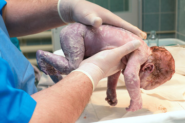 Child after birth