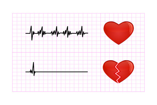 Heartbeat diagram